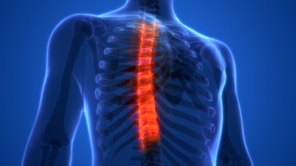 osteocondrose da coluna torácica