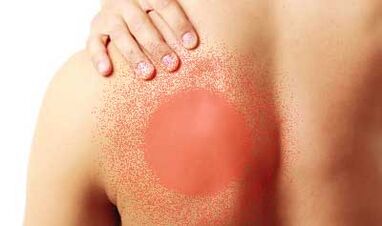 dor sob a omoplata esquerda